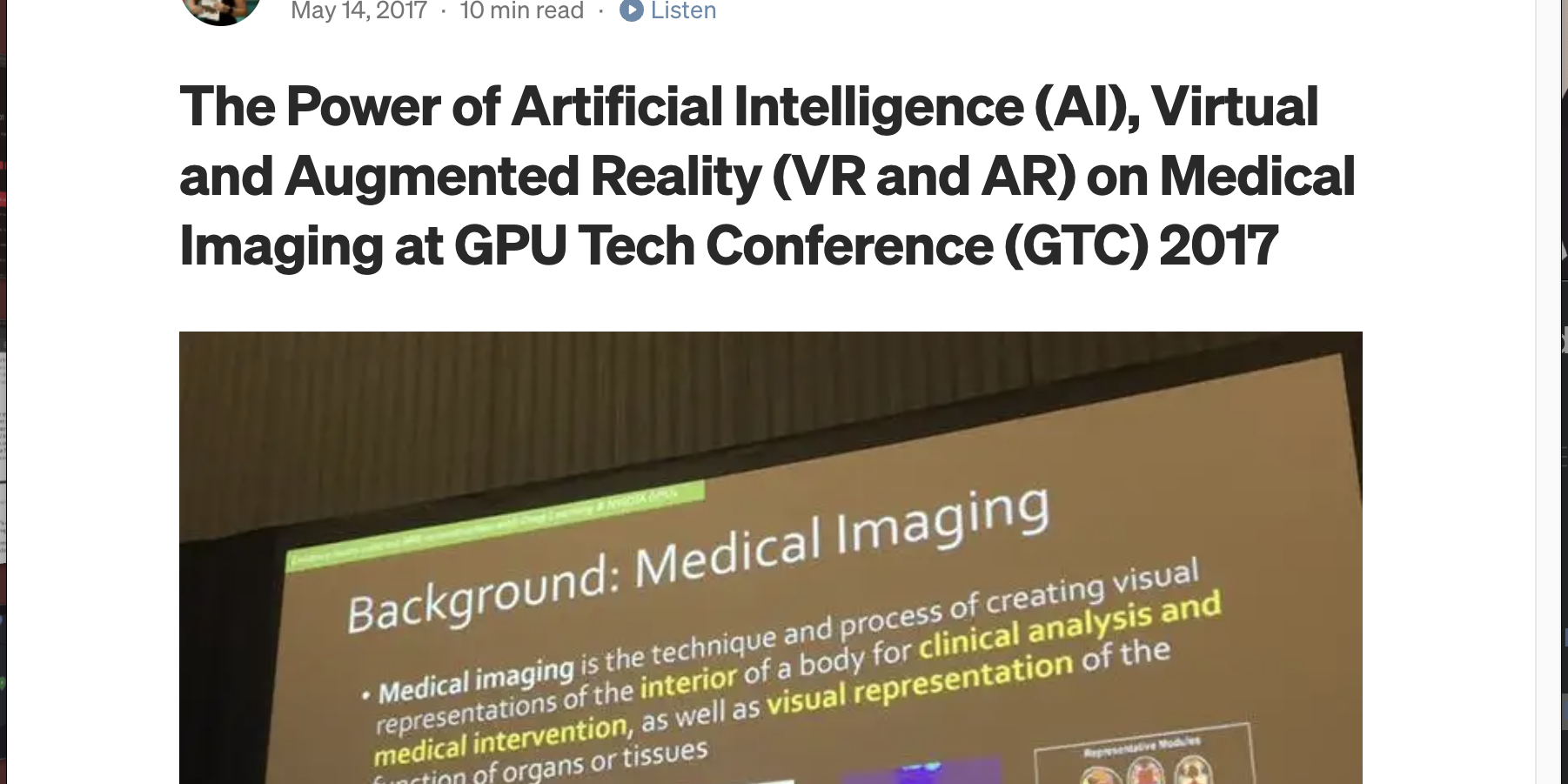 The Power of Artificial Intelligence (AI), Virtual and Augmented Reality (VR and AR) on Medical Imaging at GPU Tech Conference (GTC) 2017